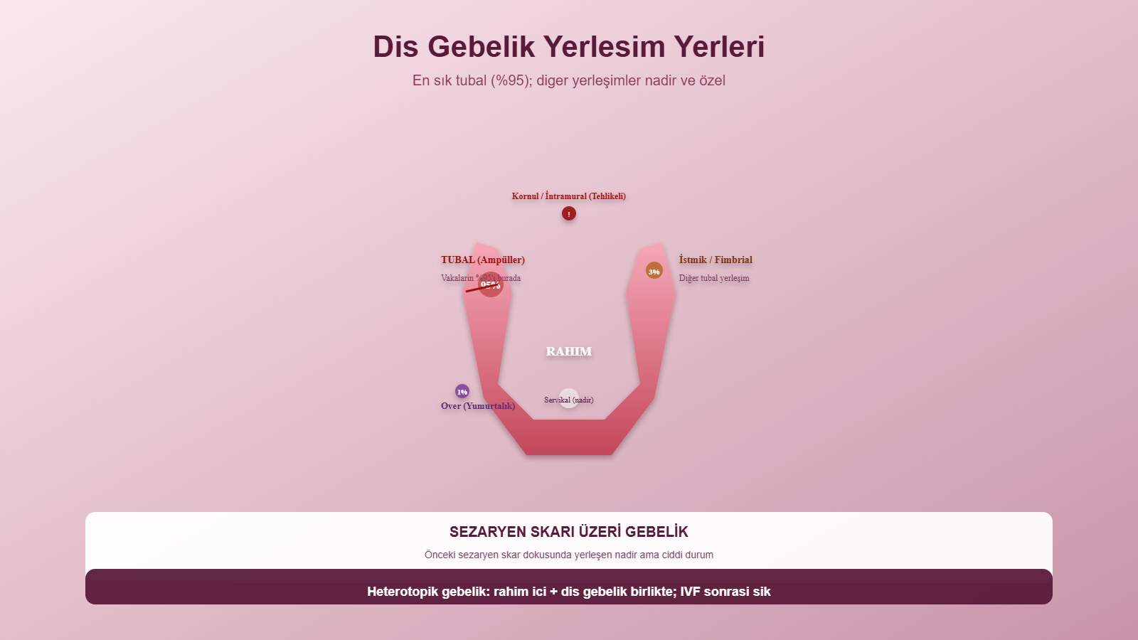 Dış Gebelik (Ektopik Gebelik): Belirtileri, Tanı ve Tedavisi 1 Dış gebelik yerleşim yerleri: tubal, servikal, over, intramural ve sezaryen skarı