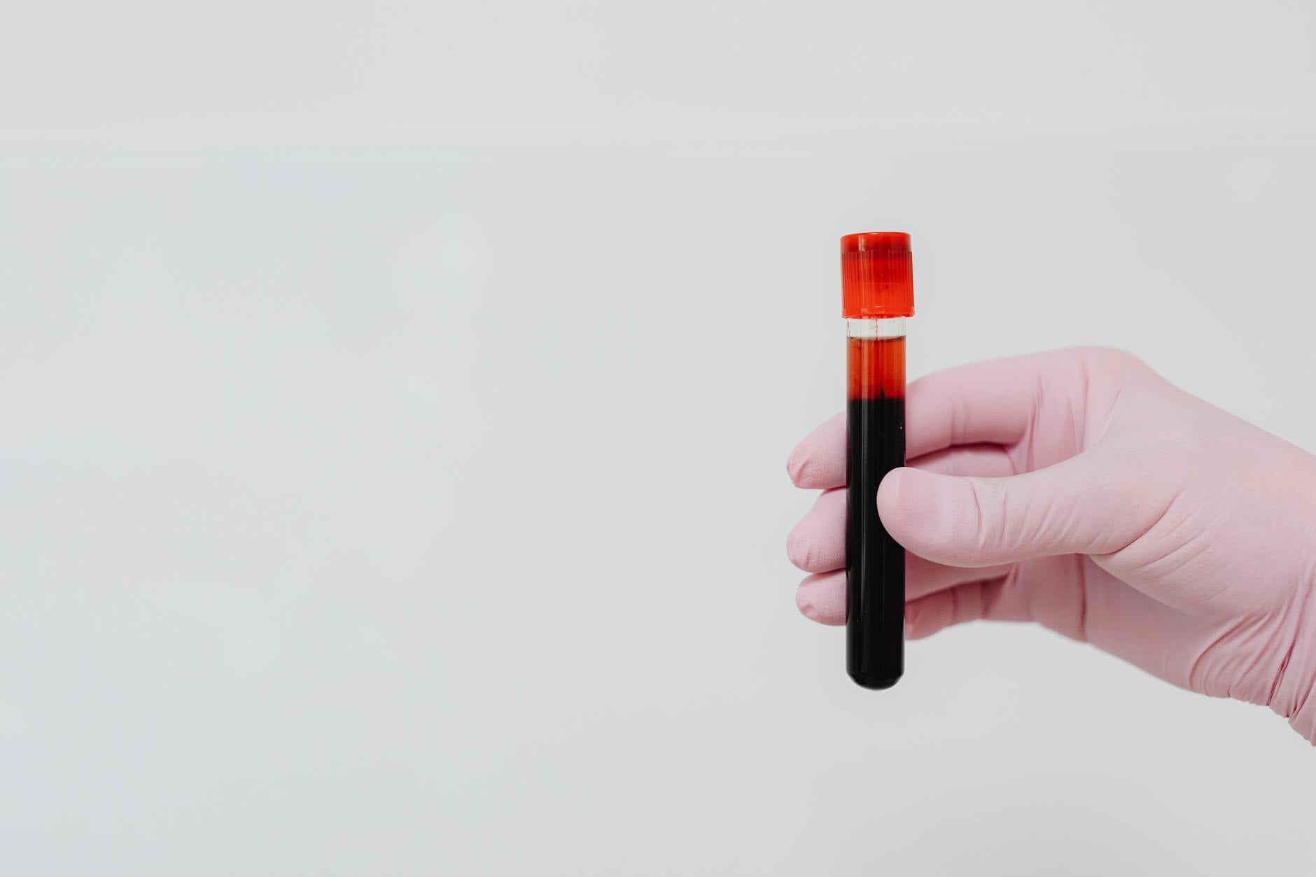 HbA1c Nedir? Şeker Testi Normal Aralığı ve Değer Y görseli 3